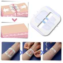 Carica l'immagine nel visualizzatore di Gallery, Adesivo per ferite impermeabile - Ozerty