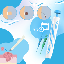 Carica l'immagine nel visualizzatore di Gallery, Tecnica di legatura per la rimozione - Ozerty