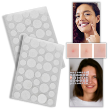 Carica l'immagine nel visualizzatore di Gallery, Confezione da 36 cerotti invisibili per l'acne - Ozerty
