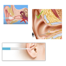 Carica l&#39;immagine nel visualizzatore di Gallery, 3 in 1 Telecamera auricolare - Ozerty
