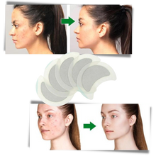 Carica l&#39;immagine nel visualizzatore di Gallery, 5 x Cerotti a base di erbe antisudore
