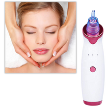 Carica l&#39;immagine nel visualizzatore di Gallery, Aspiratore per punti neri - Ozerty
