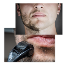 Carica l'immagine nel visualizzatore di Gallery, Rullo Derma per la crescita di capelli e barba

