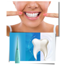 Carica l'immagine nel visualizzatore di Gallery, Macchina per la pulizia profonda del tartaro dei denti
