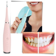 Carica l'immagine nel visualizzatore di Gallery, Macchina per la pulizia profonda del tartaro dei denti - Ozerty
