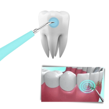 Carica l'immagine nel visualizzatore di Gallery, Macchina per la pulizia profonda del tartaro dei denti - Ozerty
