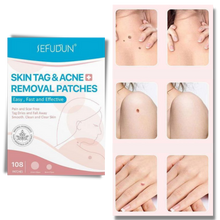 Carica l&#39;immagine nel visualizzatore di Gallery, Cerotto per il trattamento di rimozione delle escrescenze della pelle - Ozerty

