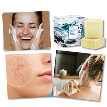 Carica l'immagine nel visualizzatore di Gallery, Sapone antiacne naturale al sale marino - Ozerty
